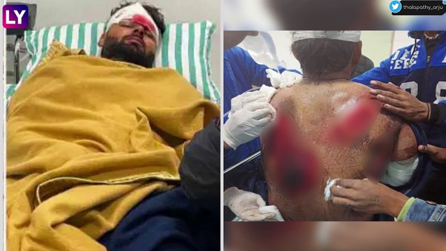 Rishabh Pant Accident: Cricketer Suffers Injuries In Car Accident On Delhi-Dehradun Highway, Condition Stable