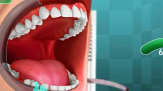 ASMR Dental Implant । Teeth Cavity Treament Animation