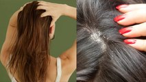 Winters में बालों को हेल्दी रखने के लिए अपनाएं ये एक Hair Care Routine, मिलेगा जबरदस्त फायदे।*Health