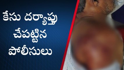 రామగిరి: లారీ, బొలెరో వాహనం ఢీ.. ఒకరికి తీవ్ర గాయాలు