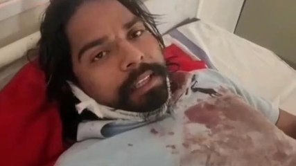 खंडवा : दो युवकों पर प्राणघातक हमला, पत्थर से फोड़ा सिर