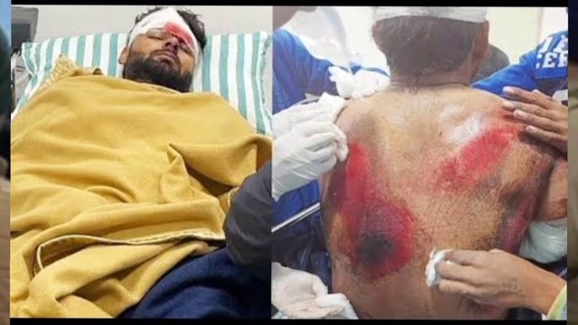 Rishabh pant news, cricketer car Accident, IND vs SL 1st t20 playing 11