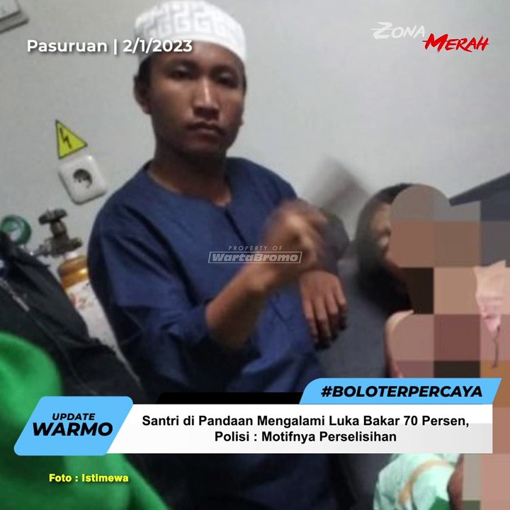 Santri di Pandaan Mengalami Luka Bakar 70 Persen | Zona Merah