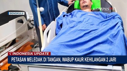 Begini Kronologi Wakil Bupati Kaur Kehilangan 2 Jarinya Akibat Terkena Ledakan Petasan!