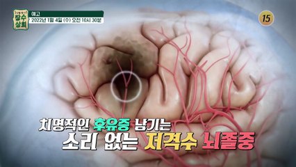 혈관 속 염증 다스릴 특별한 비법_장수상회 26회 예고 TV CHOSUN 230104 방송