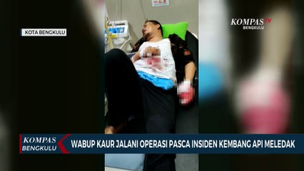 Wabup Kaur Jalani Operasi Pasca Insiden Kembang Api Meledak