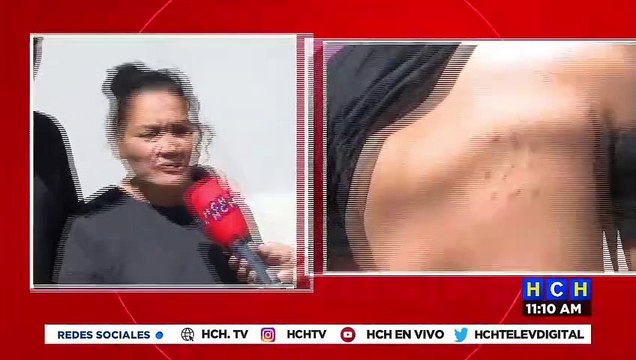 ¡Tras arrestos en la capital! Denuncian supuestas torturas por parte de agentes del orden