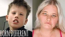 The People Who Can't Smile | BORN DIFFERENT