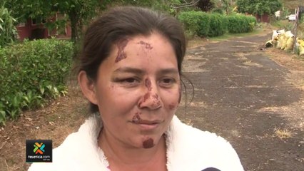 tn7-Madre soltera de tres hijas menores de edad es una de las sobrevivientes a vuelco de chapulín-020123