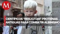 En España, científicos buscan combatir las condiciones del albinismo
