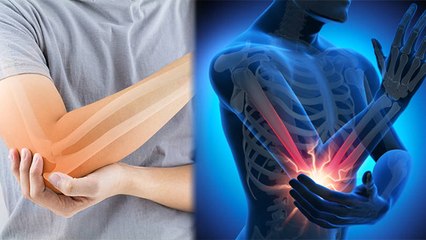 कोहनी में दर्द क्यों होता है, कोहनी में दर्द होने का कारण | Boldsky *Health