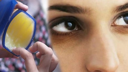 पेट्रोलियम जेली से डार्क सर्कल ठीक होते है क्या, डार्क सर्कल कैसे ठीक करें |Boldsky *Health