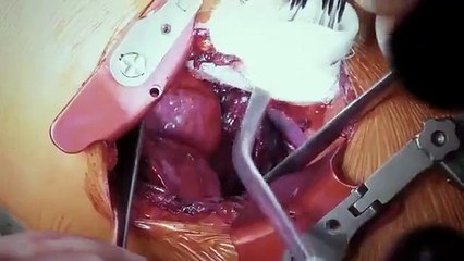 Surgeons - At the Edge of Life - Se3 - Ep03 HD Watch