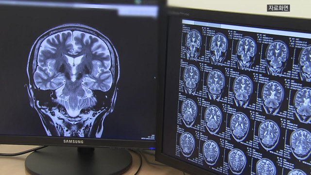 [뉴스라이더] 병역 비리 연루 '최대 100명'...판도라의 상자 열리나? / YTN