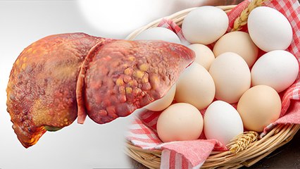 Download Video: फैटी लिवर में अंडा खाना चाहिए या नहीं | Eating Eggs In Fatty Liver Safe or Not | Boldsky *Health