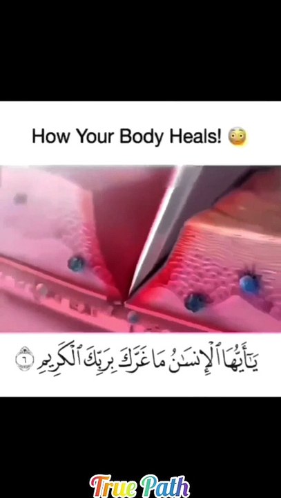 Look how ur body heals❓️Ever wondered`That is his creation Still you don't believe‼️O man look