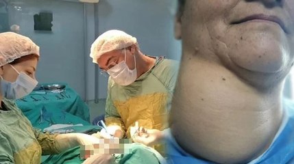 Yıllarca ameliyattan korktu, boynundan 800 gram kitle çıktı