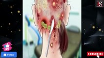 ASMR Infected Scalp Treatment|treatment of infection|head lice treatment|  @asmrstudiounlimited  #asmr