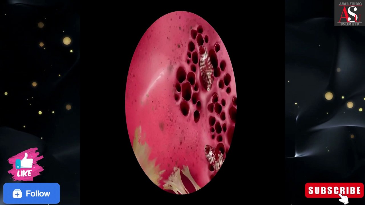 ASMR Maggots Removal|botfly maggot removal|maggot removal|maggot infection @asmrstudiounlimited #asmr