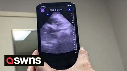 Mum with heart-shaped uterus defies the odds to give birth to one-in-500 million twins