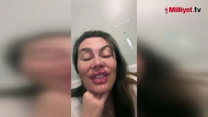 Demet Evgar, botoks ve dolguyu abartan isimleri tiye aldı