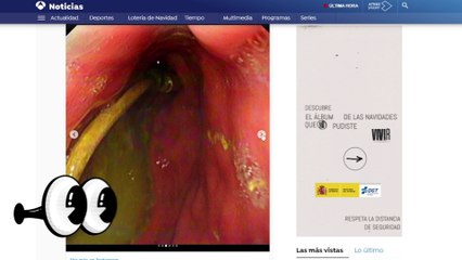 Un MENOR de  15 años tenía un cable USB en el estómago