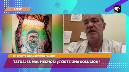 Tatuajes mal hechos: ¿Existe una solución?
