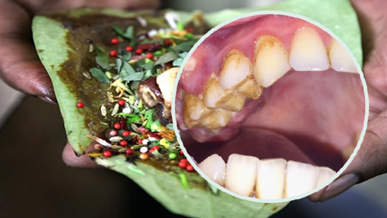 ज्यादा पान खाने से क्या होता है | ज्यादा पान खाने नुकसान | Paan Khane Ke Nuksan | Boldsky