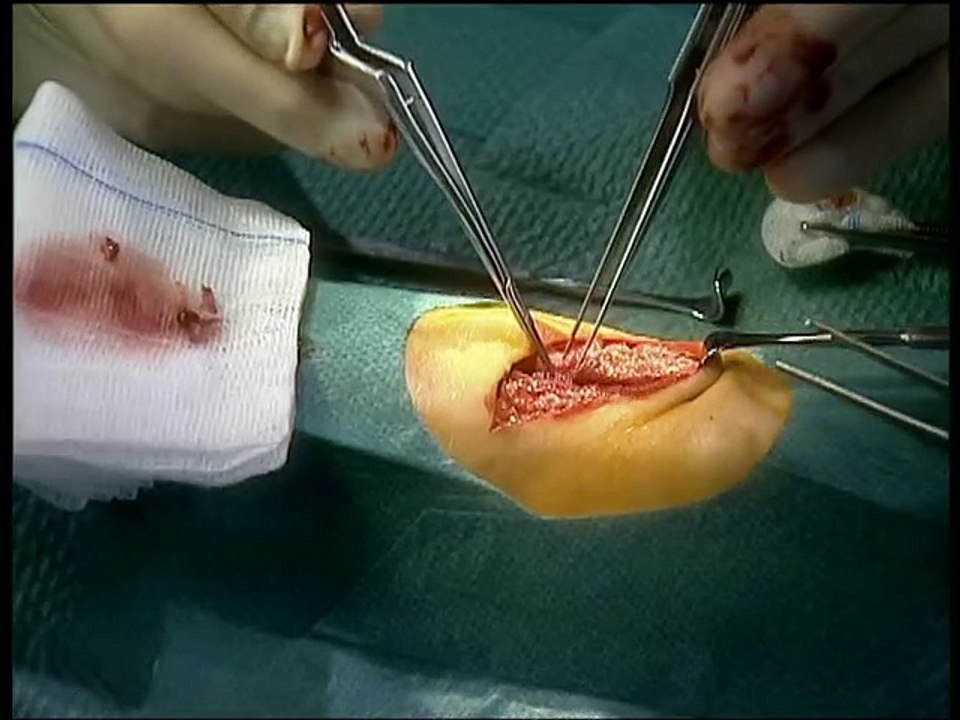 Alphateam - Die Lebensretter im OP Staffel 6 Folge 20