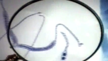 Diagnosis Murder S08E22 The Blair Nurse Project