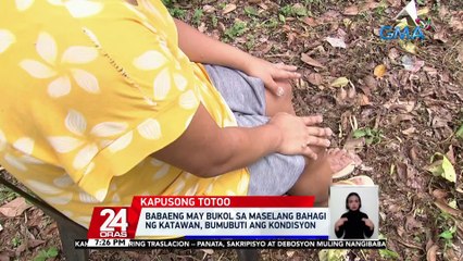 Babaeng may bukol sa maselang bahagi ng katawan, bumubuti ang kondisyon | 24 Oras