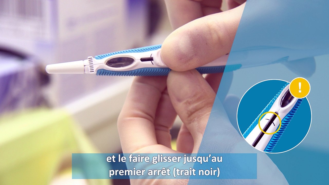 Procédure d’injection intravitréenne d'Iluvien