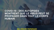 Covid-19: les autopsies montrent que le virus peut se propager dans tout le corps humain