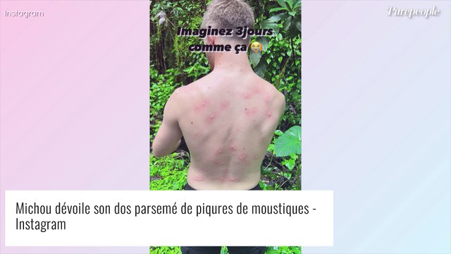 Ils m'ont charcuté : Michou attaqué dans la jungle, les images impressionnantes de son dos très abîmé