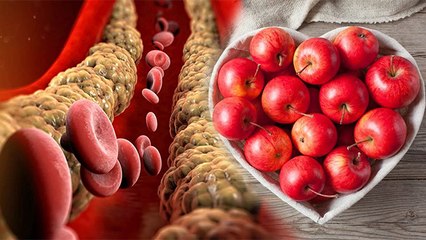 High Cholesterol में इस एक Fruit को खाने से मिलेगी राहत, जानें इसे खाने के फायदे | Boldsky *Health