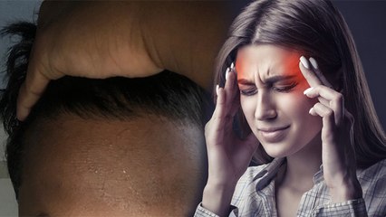 माथे का कालापन हल्के में लेना पड़ेगा भारी, इस बीमारी के कारण होती है ये परेशानी | Boldsky *Health