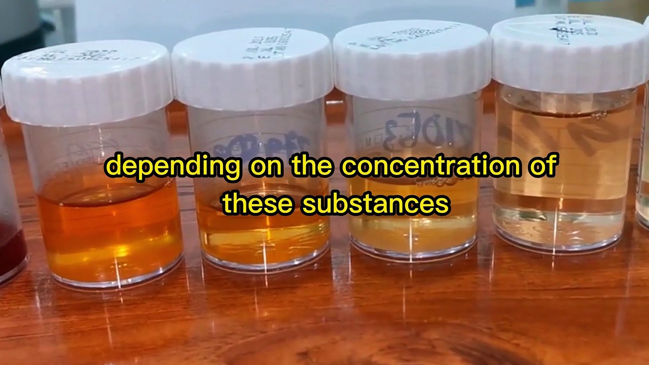Don't Ignore Your Urine Color: The Surprising Effects on Your Health