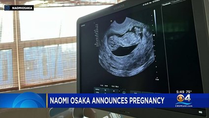 Tennis Star Naomi Osaka Announces Pregnancy