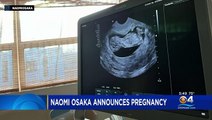 Tennis Star Naomi Osaka Announces Pregnancy