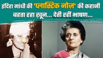 Indira Gandhi के Plastic Nose की क्या है कहानी ? | Congress | वनइंडिया प्लस