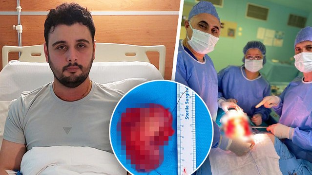 Kırık dişi hayatını kâbusa çevirdi: Yemek yiyemedi, konuşamadı