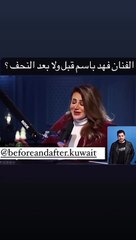 فهد باسم يصدم جمهوره بعد خسارته 30 كيلو من الوزن