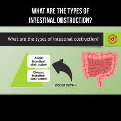 What are the types of intestinal obstruction?