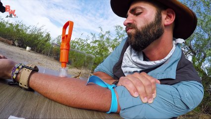 VENOM EXTRACTION - Centipede Bite Aftermath!