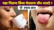 जीभ भाजली तर काय करावं ? How to Heal Burnt Tongue | Burning Tongue Remedies | Lokmat Bhakti |RI3