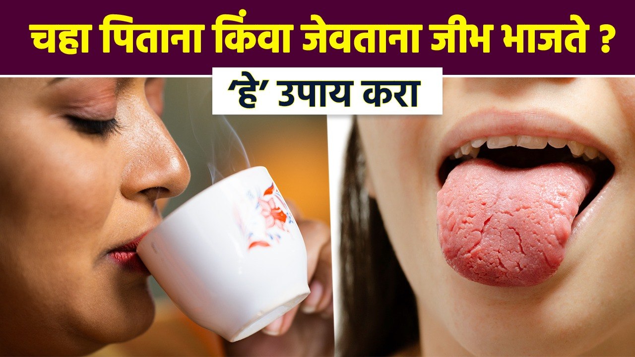 जीभ भाजली तर काय करावं ? How to Heal Burnt Tongue | Burning Tongue Remedies | Lokmat Bhakti |RI3