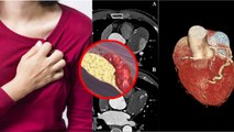 दिल की धमनी फटने के लक्षण | Rupture In Artery Kya Hota Hai | SCAD Kya Hai | Boldsky