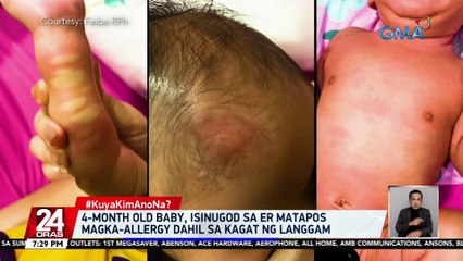 4-month old baby, isinugod sa ER matapos magka-allergy dahil sa kagat ng langgam | 24 Oras
