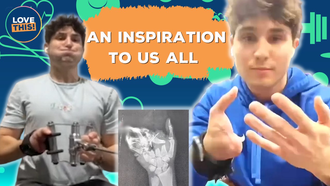 Man's CRUSHED HAND sparks incredible recovery! video Dailymotion