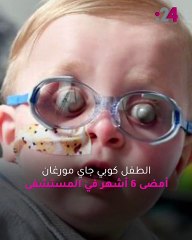 عينان جاحظتان ومنتفختان.. حالة مرضية غامضة لمولود تحير الأطباء